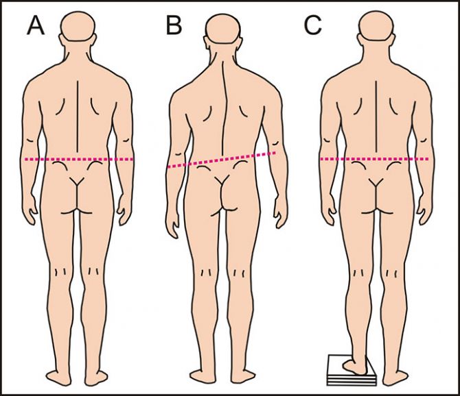Асимметрия тела человека.
